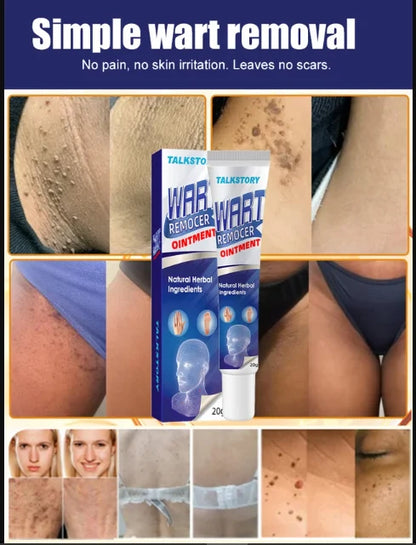 Wart Remover Gel